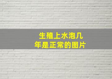 生殖上水泡几年是正常的图片