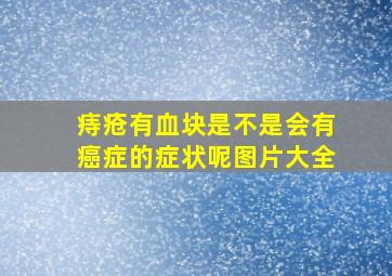 痔疮有血块是不是会有癌症的症状呢图片大全