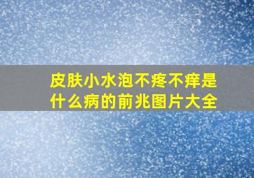 皮肤小水泡不疼不痒是什么病的前兆图片大全