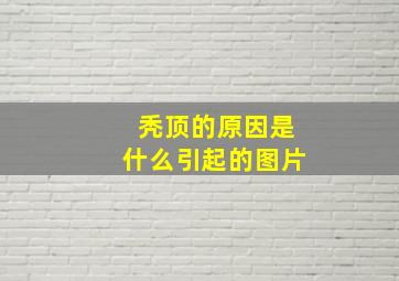 秃顶的原因是什么引起的图片