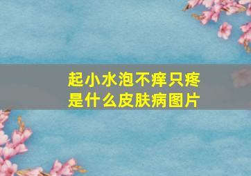 起小水泡不痒只疼是什么皮肤病图片